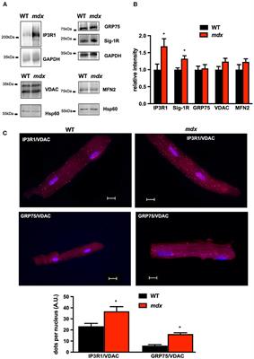 Metformin Reverses the Enhanced Myocardial SR/ER–Mitochondria Interaction and Impaired Complex I-Driven Respiration in Dystrophin-Deficient Mice